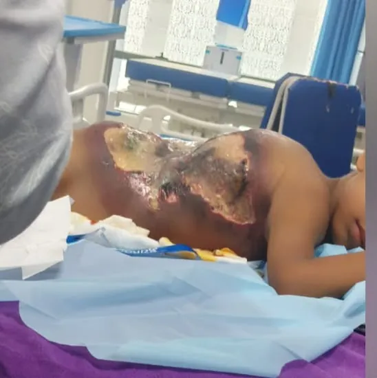 Gowtham's back during his illness in hospital